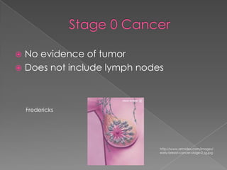 Stage 0 CancerNo evidence of tumorDoes not include lymph nodesFrederickshttp://www.arimidex.com/images/early-breast-cancer-stage-0_lg.jpg
