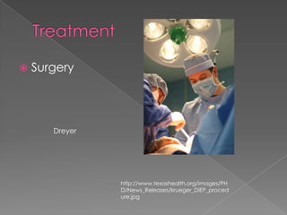 TreatmentSurgeryDreyerhttp://www.texashealth.org/images/PHD/News_Releases/krueger_DIEP_procedure.jpg