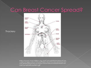 Can Breast Cancer Spread?Thackeryhttp://www.macmillan.org.uk/Cancerinformation/Cancertypes/Breastsecondary/Aboutsecondarybreastcancer/Lymphaticsystem.gif