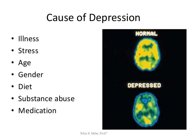 What Makes Kids With Autism Less Social >> SGP- Depression What Makes Kids With Autism Less Social >> SGP- Depression