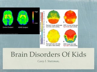 Brain Disorders Of Kids
        Casey L Stutzman
 