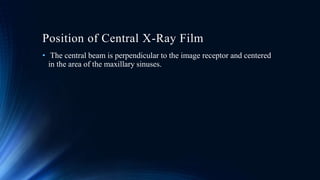Position of Central X-Ray Film
• The central beam is perpendicular to the image receptor and centered
in the area of the maxillary sinuses.
 