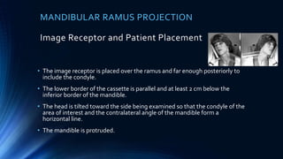 MANDIBULAR RAMUS PROJECTION
Image Receptor and Patient Placement
• The image receptor is placed over the ramus and far enough posteriorly to
include the condyle.
• The lower border of the cassette is parallel and at least 2 cm below the
inferior border of the mandible.
• The head is tilted toward the side being examined so that the condyle of the
area of interest and the contralateral angle of the mandible form a
horizontal line.
• The mandible is protruded.
 