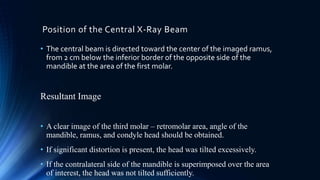Position of the Central X-Ray Beam
• The central beam is directed toward the center of the imaged ramus,
from 2 cm below the inferior border of the opposite side of the
mandible at the area of the first molar.
Resultant Image
• A clear image of the third molar – retromolar area, angle of the
mandible, ramus, and condyle head should be obtained.
• If significant distortion is present, the head was tilted excessively.
• If the contralateral side of the mandible is superimposed over the area
of interest, the head was not tilted sufficiently.
 