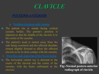 SHOULDER JOINT | PPTX