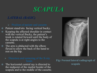 SHOULDER JOINT | PPTX