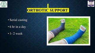ORTHOTIC SUPPORT
• Serial casting
• 6 hr in a day
• 1- 2 week
 