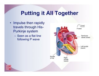 Putting it All Together
•  Impulse then rapidly
travels through His-
Purkinje system
–  Seen as a flat line
following P wave
 