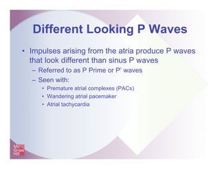 Shadechapter05.ppt [read only] | PDF