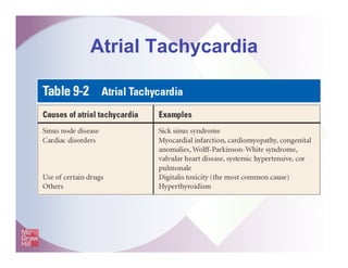 Atrial Tachycardia
 