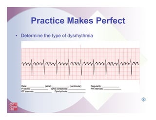 Practice Makes Perfect
• Determine the type of dysrhythmia
I
 