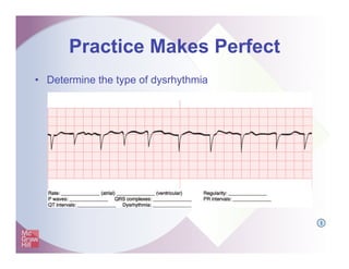 Practice Makes Perfect
• Determine the type of dysrhythmia
I
 