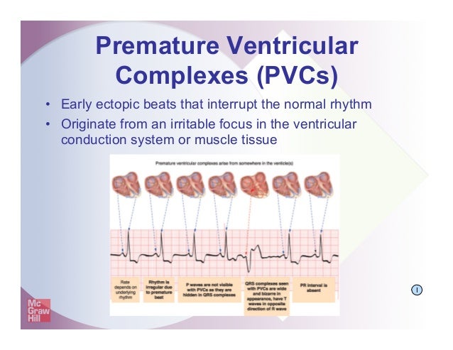 Shadechapter11.ppt [read only]