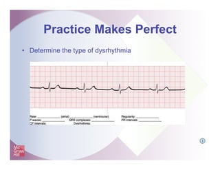 Practice Makes Perfect
•  Determine the type of dysrhythmia
I
 