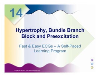 Q
I
A
14
Fast & Easy ECGs – A Self-Paced
Learning Program
Hypertrophy, Bundle Branch
Block and Preexcitation
 
