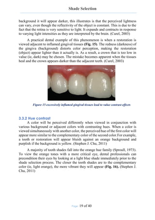 Shade Selection
Page: 19 of 40
background it will appear darker, this illustrates is that the perceived lightness
can vary, even though the reflectivity of the object is constant. This is due to the
fact that the retina is very sensitive to light. It expands and contracts in response
to varying light intensities as they are interpreted by the brain. (Curel, 2003)
A practical dental example of this phenomenon is when a restoration is
viewed adjacent to inflamed gingival tissues (Fig. 15). The redness (darkness) of
the gingiva (background) distorts color perception, making the restoration
(object) appear lighter than it actually is. As a result, a crown that is too low in
value (ie, dark) may be chosen. The mistake becomes apparent when the tissues
heal and the crown appears darker than the adjacent teeth. (Curel, 2003)
Figure 15 excessively inflamed gingival tissues lead to value contrast effects
3.3.2 Hue contrast
A color will be perceived differently when viewed in conjunction with
various background or adjacent colors with contrasting hues. When a color is
viewed simultaneously with another color, the perceived hue of the first color will
appear more similar to the complementary color of the second color.For example,
a tooth or restoration will appear bluish against an orange background and
purplish if the background is yellow. (Stephen J. Chu, 2011)
A majority of tooth shades fall into the orange hue family (Sproull, 1973).
To view the orange tones with a more critical eye, dental professionals can
precondition their eyes by looking at a light blue shade immediately prior to the
shade selection process. The closer the tooth shades are to the complementary
color (ie, light orange), the more vibrant they will appear (Fig. 16). (Stephen J.
Chu, 2011)
 