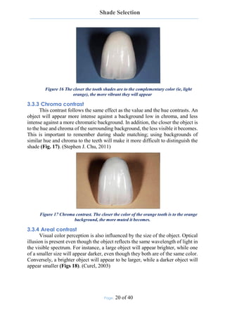Shade Selection
Page: 20 of 40
Figure 16 The closer the tooth shades are to the complementary color (ie, light
orange), th...