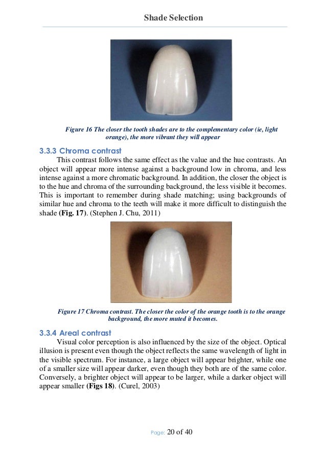 shade selection 21 638 jpg cb 1437754170 teeth shading chart