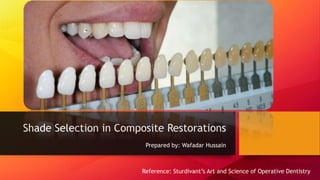 Shade Selection in Composite Restorations
Prepared by: Wafadar Hussain
Reference: Sturdivant’s Art and Science of Operative Dentistry
 
