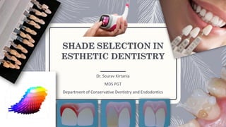 SHADE SELECTION IN
ESTHETIC DENTISTRY
Dr. Sourav Kirtania
MDS PGT
Department of Conservative Dentistry and Endodontics
 
