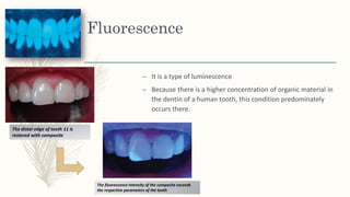 Fluorescence
– It is a type of luminescence
– Because there is a higher concentration of organic material in
the dentin of a human tooth, this condition predominately
occurs there.
The distal edge of tooth 11 is
restored with composite
The fluorescence intensity of the composite exceeds
the respective parameters of the tooth
 