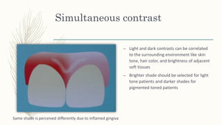 Simultaneous contrast
– Light and dark contrasts can be correlated
to the surrounding environment like skin
tone, hair color, and brightness of adjacent
soft tissues
– Brighter shade should be selected for light
tone patients and darker shades for
pigmented toned patients
Same shade is perceived differently due to inflamed gingiva
 