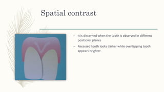Spatial contrast
– It is discerned when the tooth is observed in different
positional planes
– Recessed tooth looks darker while overlapping tooth
appears brighter
 