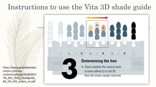 Instructions to use the Vita 3D shade guide
https://www.globaldentalso
lutions.com/wp-
content/uploads/2018/05/V
ITA_961_961E_Toothguide_
BA_EN_V03_screen_en.pdf
 