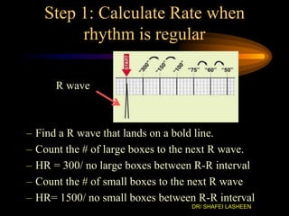 Rhythym Calculation Using 1500 Method Shafei ecg نسخة | PPTX