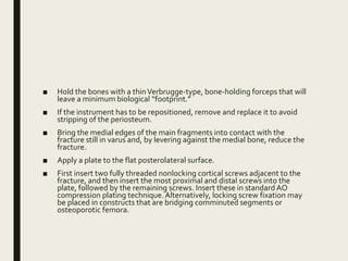 ■ Hold the bones with a thinVerbrugge-type, bone-holding forceps that will
leave a minimum biological “footprint.”
■ If the instrument has to be repositioned, remove and replace it to avoid
stripping of the periosteum.
■ Bring the medial edges of the main fragments into contact with the
fracture still in varus and, by levering against the medial bone, reduce the
fracture.
■ Apply a plate to the flat posterolateral surface.
■ First insert two fully threaded nonlocking cortical screws adjacent to the
fracture, and then insert the most proximal and distal screws into the
plate, followed by the remaining screws. Insert these in standard AO
compression plating technique.Alternatively, locking screw fixation may
be placed in constructs that are bridging comminuted segments or
osteoporotic femora.
 