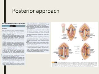 Posterior approach
 