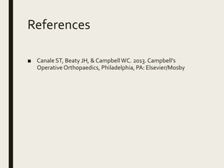 References
■ Canale ST, Beaty JH, & CampbellWC. 2013. Campbell’s
Operative Orthopaedics, Philadelphia, PA: Elsevier/Mosby
 