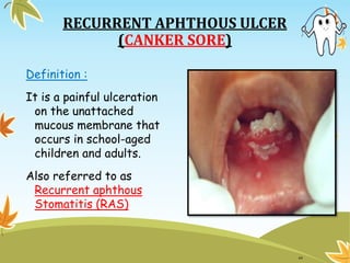 Minor Ras Ulcers Gingival and Periondantal diseases in children | PPTX