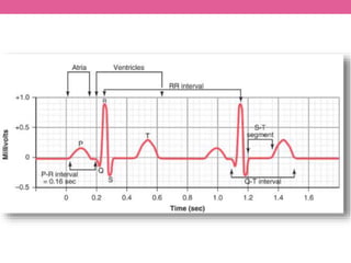 ECG | PPTX