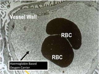 Haemoglobin Based
Oxygen Carrier
 