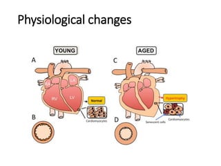 Physiological changes
 