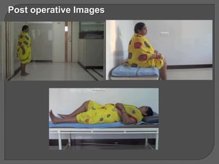 Post operative Images