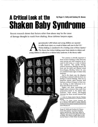 Shaken baby is a myth forensic science | PDF