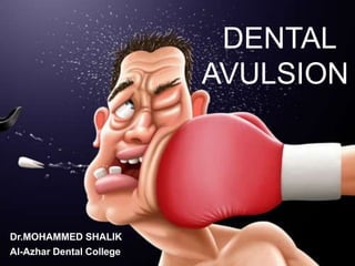 DENTAL
AVULSION
Dr.MOHAMMED SHALIK
Al-Azhar Dental College
 