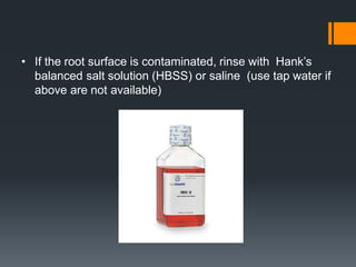 • If the root surface is contaminated, rinse with Hank’s
balanced salt solution (HBSS) or saline (use tap water if
above are not available)
 