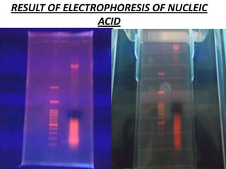 RESULT OF ELECTROPHORESIS OF NUCLEIC
ACID

 