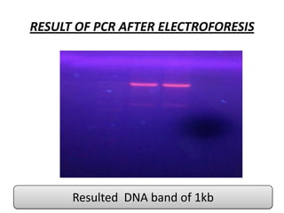 RESULT OF PCR AFTER ELECTROFORESIS

Resulted DNA band of 1kb

 