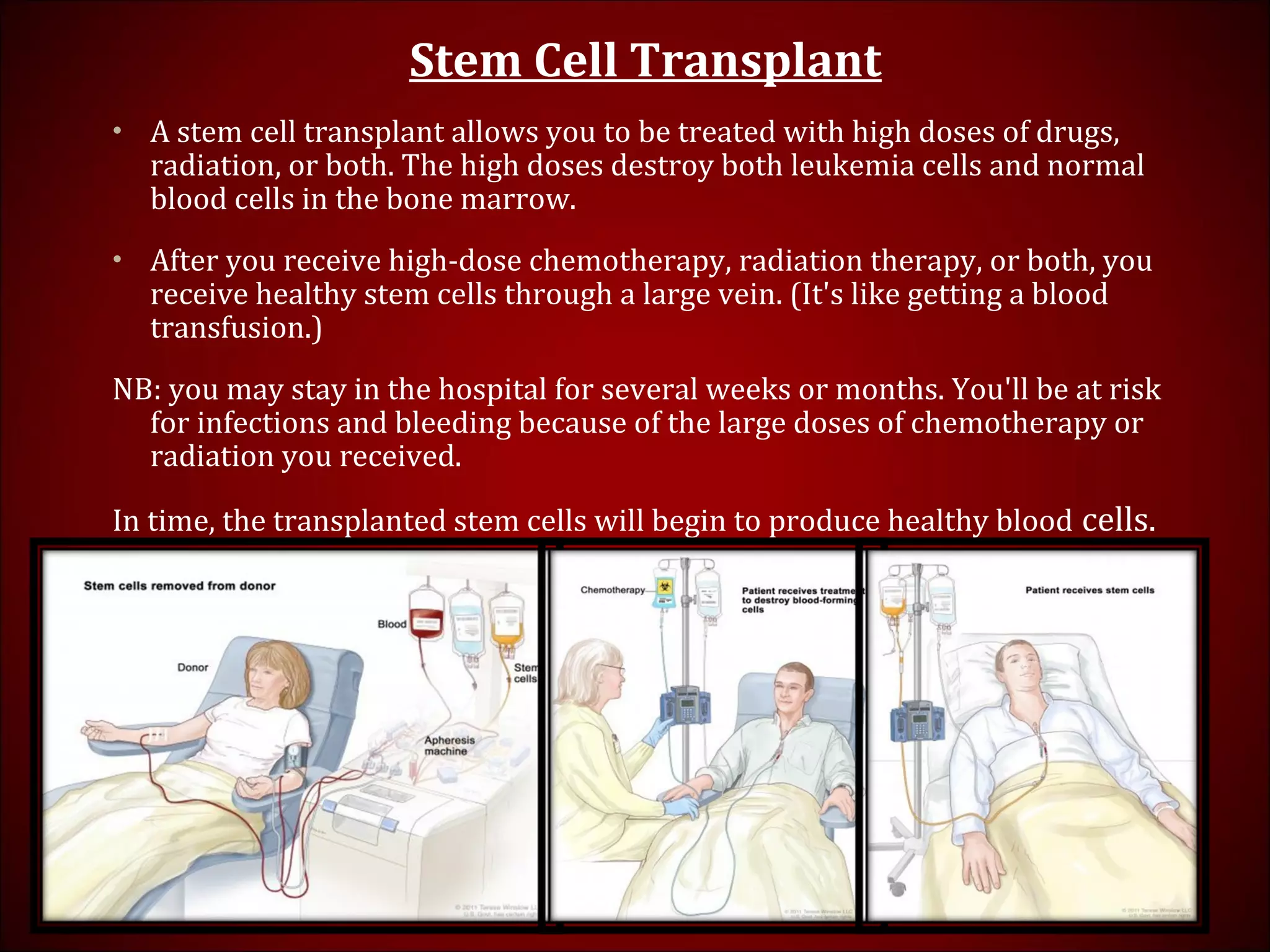 Stem Cell Transplant
• A stem cell transplant allows you to be treated with high doses of drugs,
radiation, or both. The high doses destroy both leukemia cells and normal
blood cells in the bone marrow.
• After you receive high-dose chemotherapy, radiation therapy, or both, you
receive healthy stem cells through a large vein. (It's like getting a blood
transfusion.)
NB: you may stay in the hospital for several weeks or months. You'll be at risk
for infections and bleeding because of the large doses of chemotherapy or
radiation you received.
In time, the transplanted stem cells will begin to produce healthy blood cells.
 
