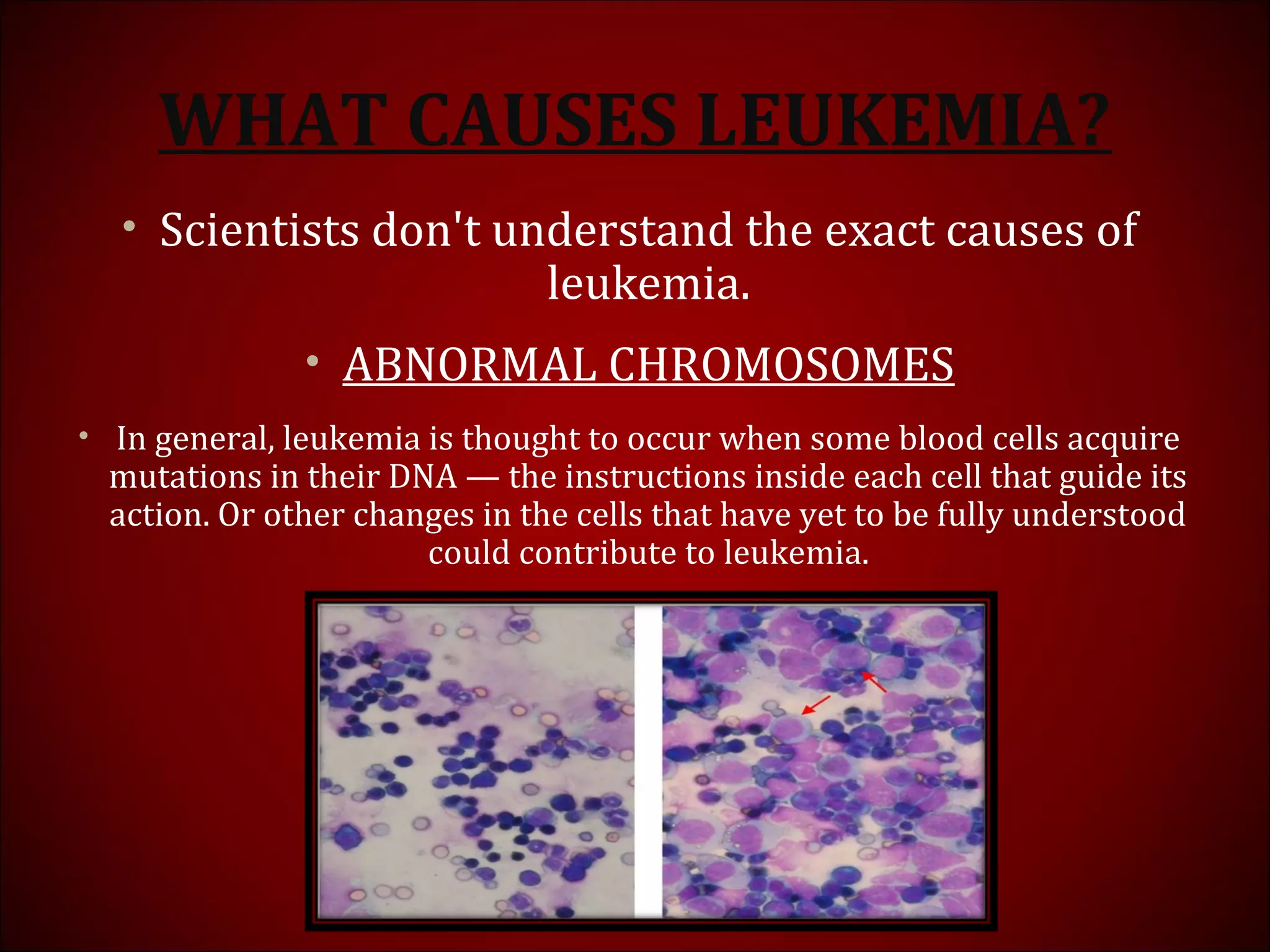 WHAT CAUSES LEUKEMIA?
• Scientists don't understand the exact causes of
leukemia.
• ABNORMAL CHROMOSOMES
• In general, leukemia is thought to occur when some blood cells acquire
mutations in their DNA — the instructions inside each cell that guide its
action. Or other changes in the cells that have yet to be fully understood
could contribute to leukemia.
 