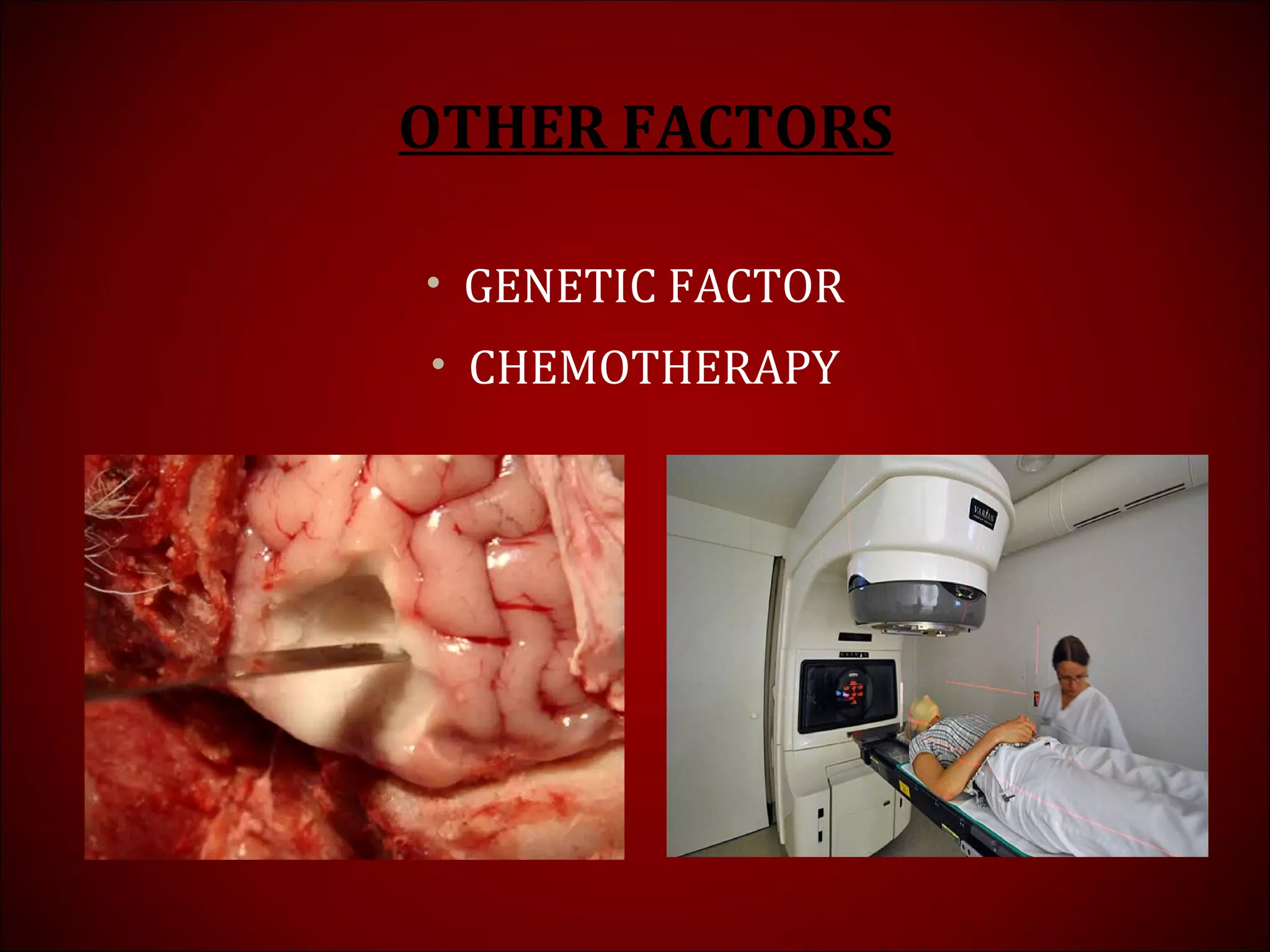 OTHER FACTORS
• GENETIC FACTOR
• CHEMOTHERAPY
 
