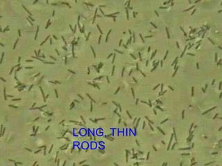 LONG, THIN
RODS
 