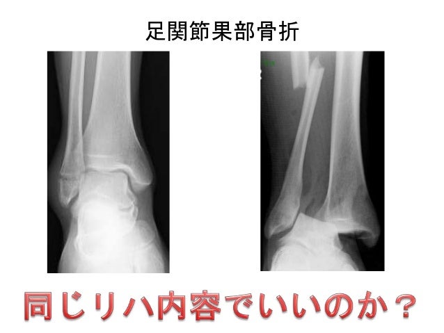 整形外科外傷理学療法研究会 足関節 整形外科外傷理学療法研究会 足関節