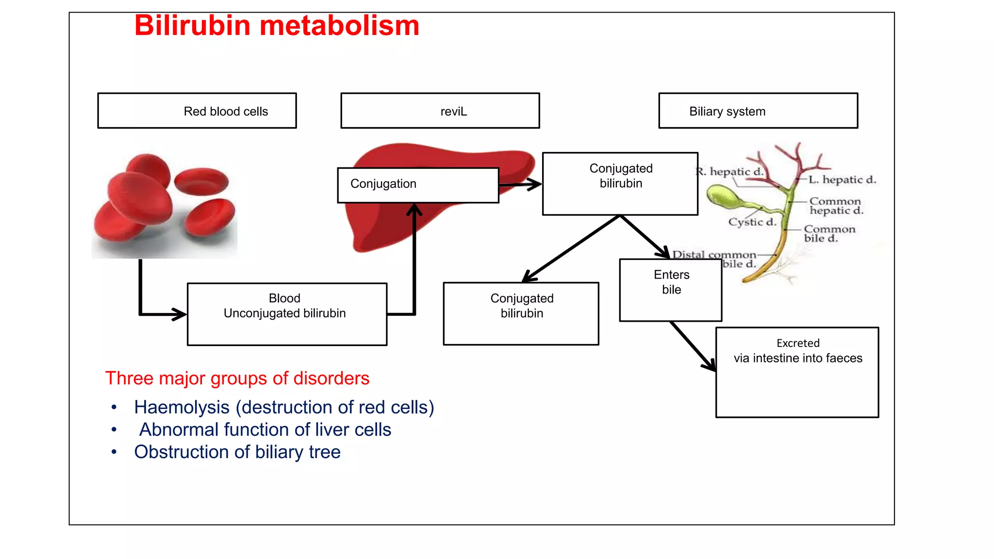 Red blood cells reviL Biliary system
Conjugation
Conjugated
bilirubin
Blood
Unconjugated bilirubin
Conjugated
bilirubin
Enters
bile
Three major groups of disorders
• Haemolysis (destruction of red cells)
• Abnormal function of liver cells
• Obstruction of biliary tree
Excreted
via intestine into faeces
Bilirubin metabolism
 