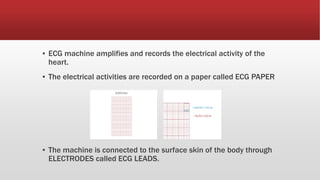 ▪ ECG machine amplifies and records the electrical activity of the
heart.
▪ The electrical activities are recorded on a paper called ECG PAPER
▪ The machine is connected to the surface skin of the body through
ELECTRODES called ECG LEADS.
 