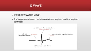 Q WAVE
▪ FIRST DOWNWARD WAVE
▪ The impulse arrives at the interventricular septum and the septum
contracts.
 